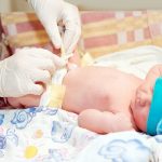 Chăm sóc rốn trẻ sơ sinh sau khi rụng